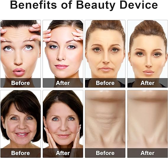 Eye Beauty Skincare Device For Radian Skin