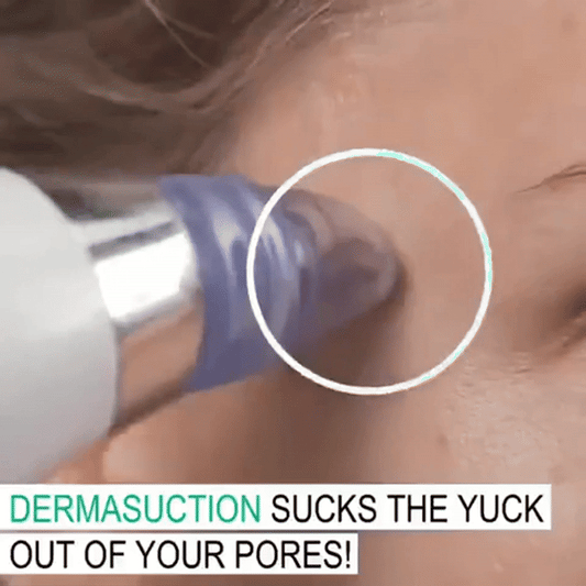 Blackhead Remover Only For Ladies