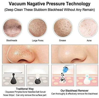 Blackhead Remover Only For Ladies